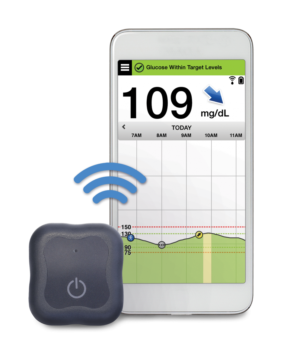 cgm implant